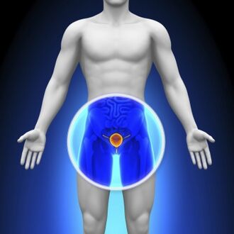 Prostatitis en un hombre