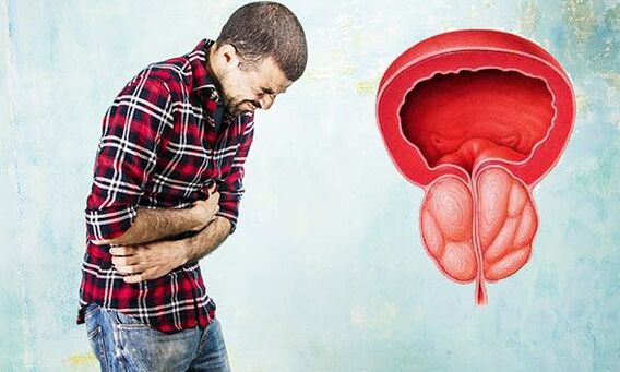 sintomas de prostatitis en hombres