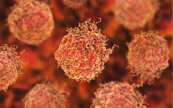 Células cancerosas de próstata